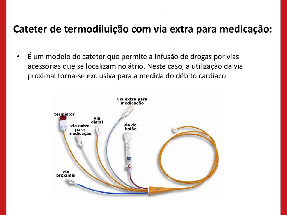 acessórias que se localizam no átrio.