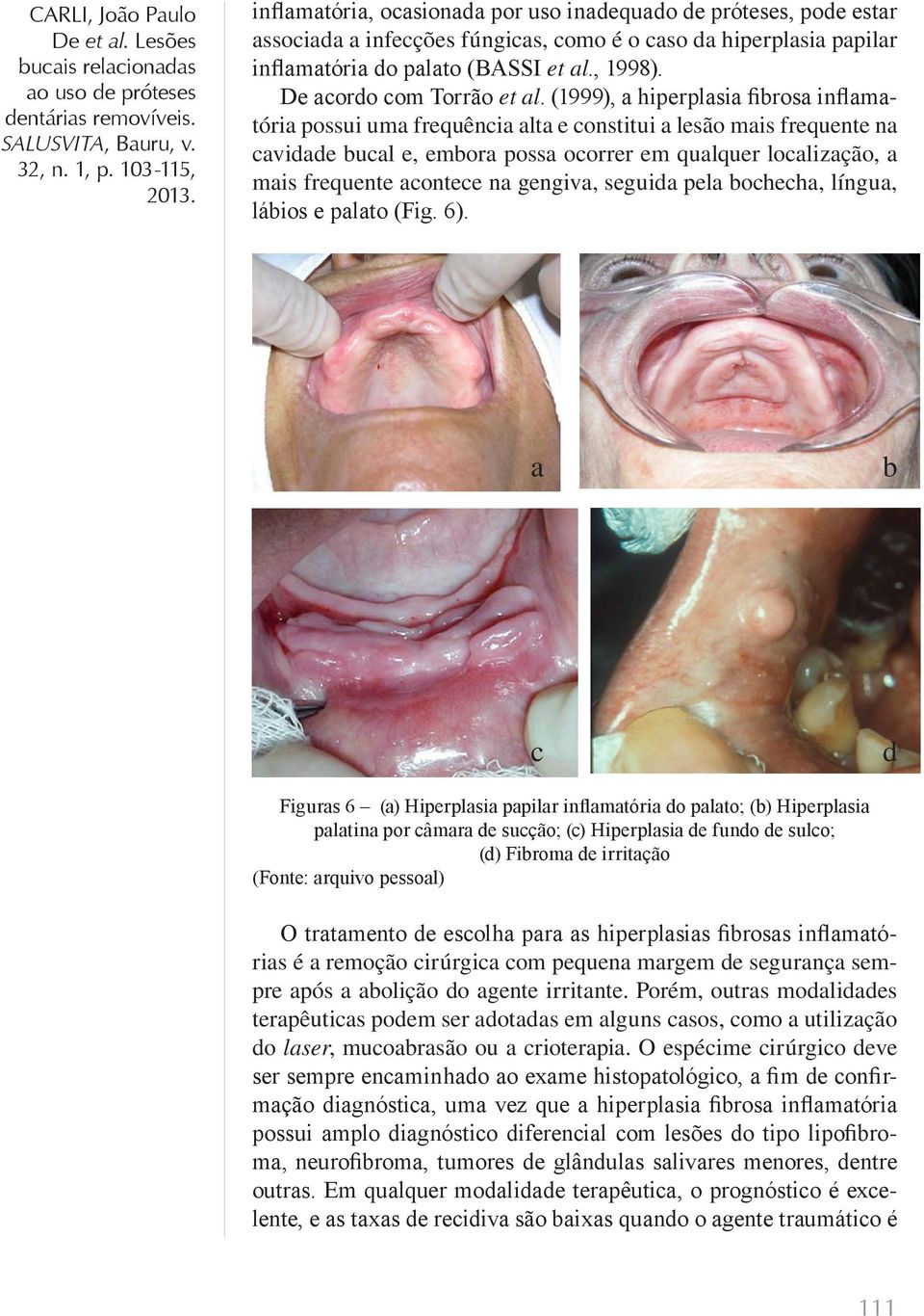(1999), a hiperplasia fibrosa inflamatória possui uma frequência alta e constitui a lesão mais frequente na cavidade bucal e, embora possa ocorrer em qualquer localização, a mais frequente acontece