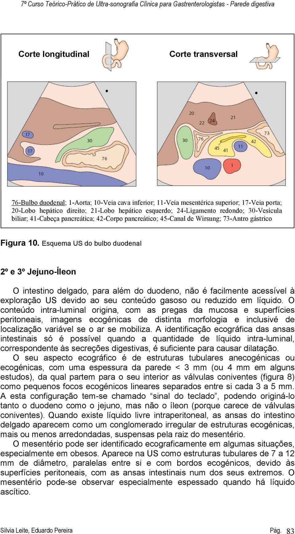 Esquema US do bulbo duodenal 2º e 3º Jejuno-Íleon O intestino delgado, para além do duodeno, não é facilmente acessível à exploração US devido ao seu conteúdo gasoso ou reduzido em líquido.