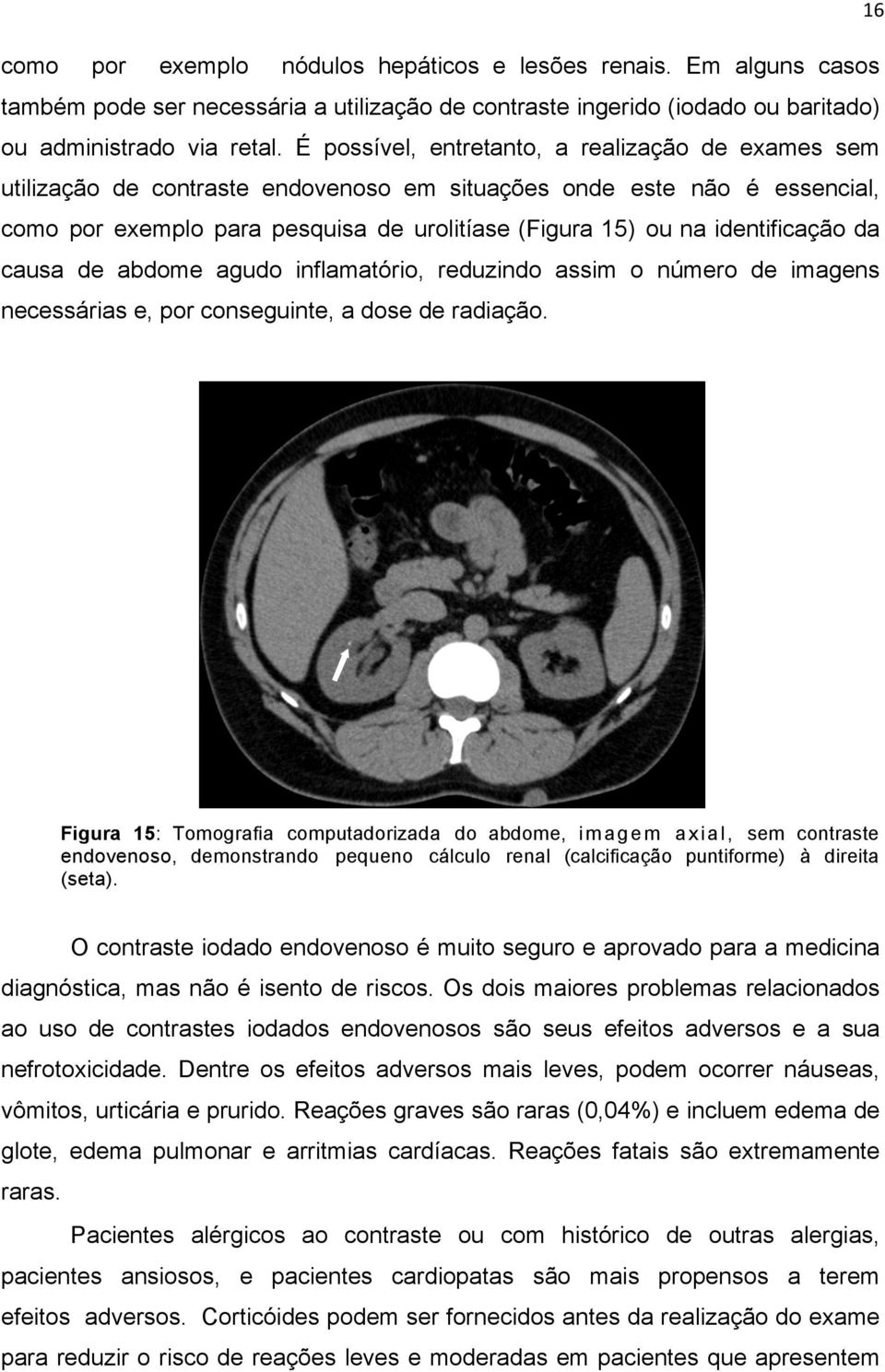 identificação da causa de abdome agudo inflamatório, reduzindo assim o número de imagens necessárias e, por conseguinte, a dose de radiação.