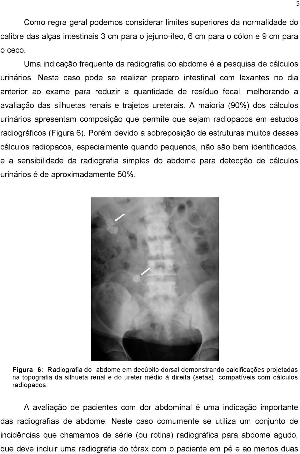 Neste caso pode se realizar preparo intestinal com laxantes no dia anterior ao exame para reduzir a quantidade de resíduo fecal, melhorando a avaliação das silhuetas renais e trajetos ureterais.