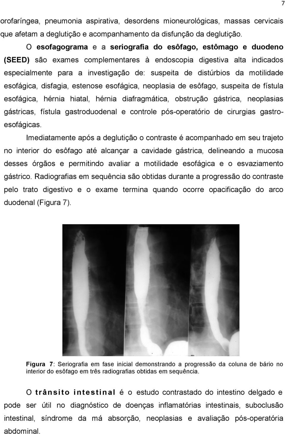 motilidade esofágica, disfagia, estenose esofágica, neoplasia de esôfago, suspeita de fístula esofágica, hérnia hiatal, hérnia diafragmática, obstrução gástrica, neoplasias gástricas, fístula