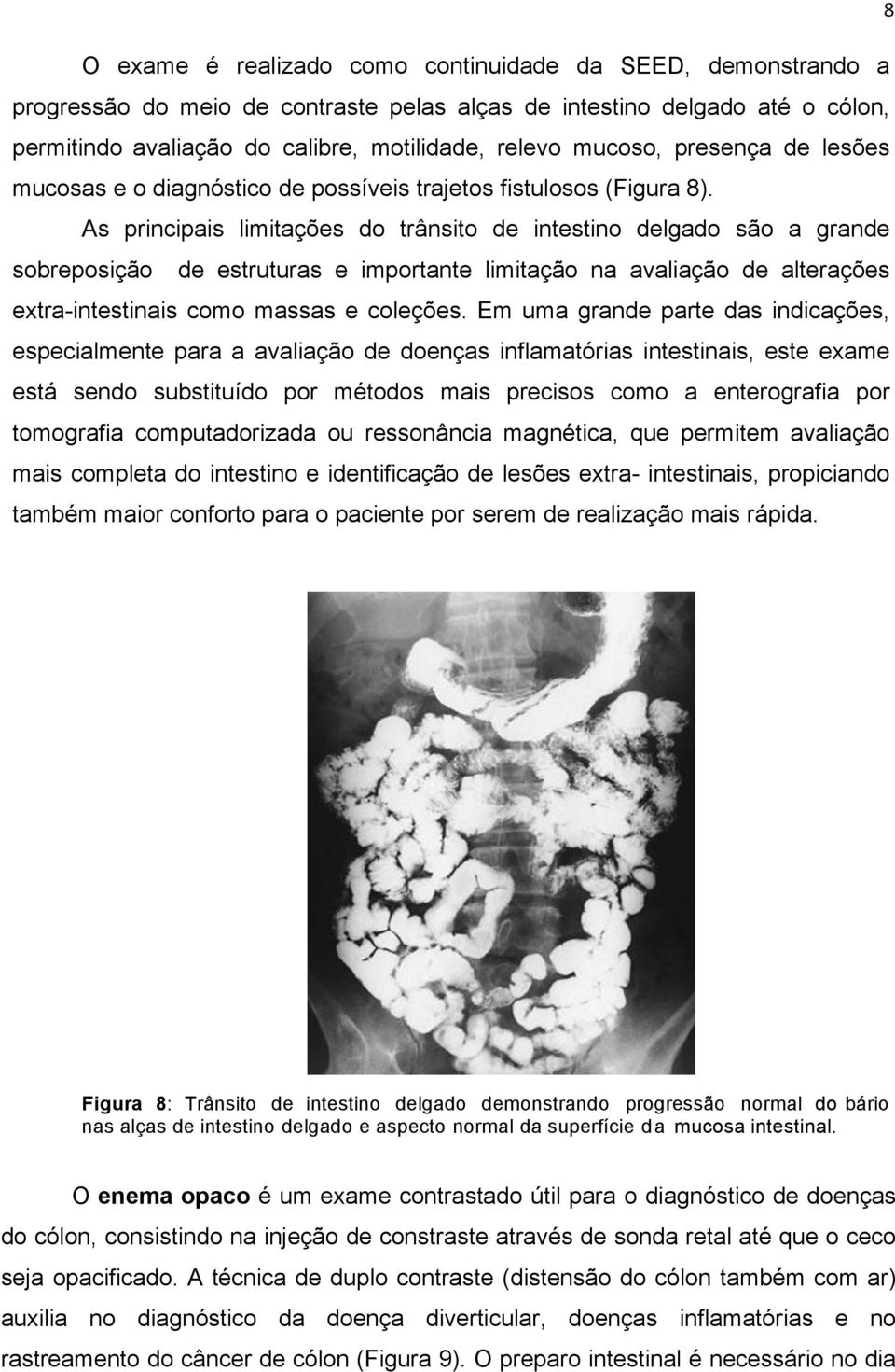 As principais limitações do trânsito de intestino delgado são a grande sobreposição de estruturas e importante limitação na avaliação de alterações extra-intestinais como massas e coleções.