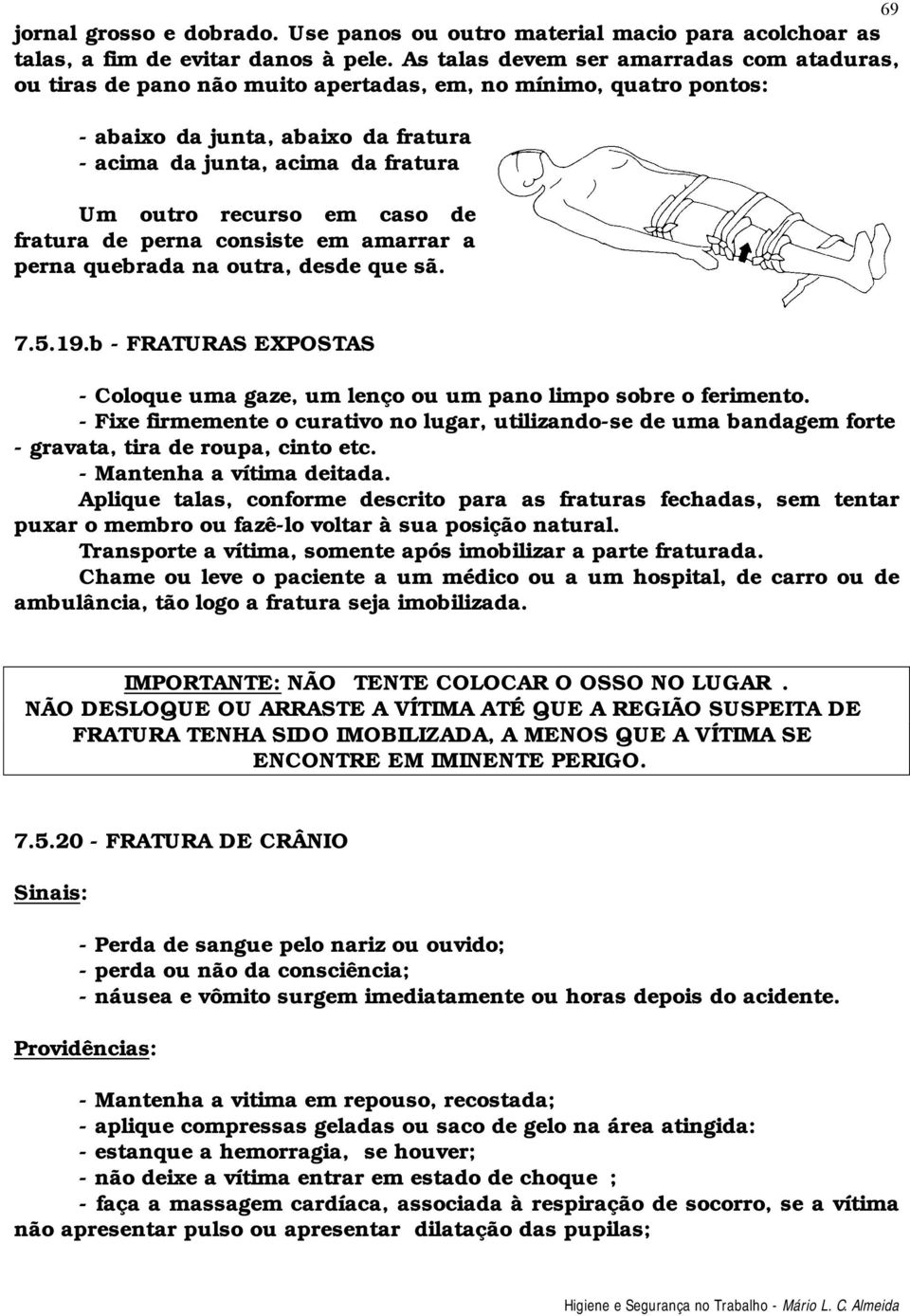 em caso de fratura de perna consiste em amarrar a perna quebrada na outra, desde que sã. 7.5.19.b - FRATURAS EXPOSTAS - Coloque uma gaze, um lenço ou um pano limpo sobre o ferimento.