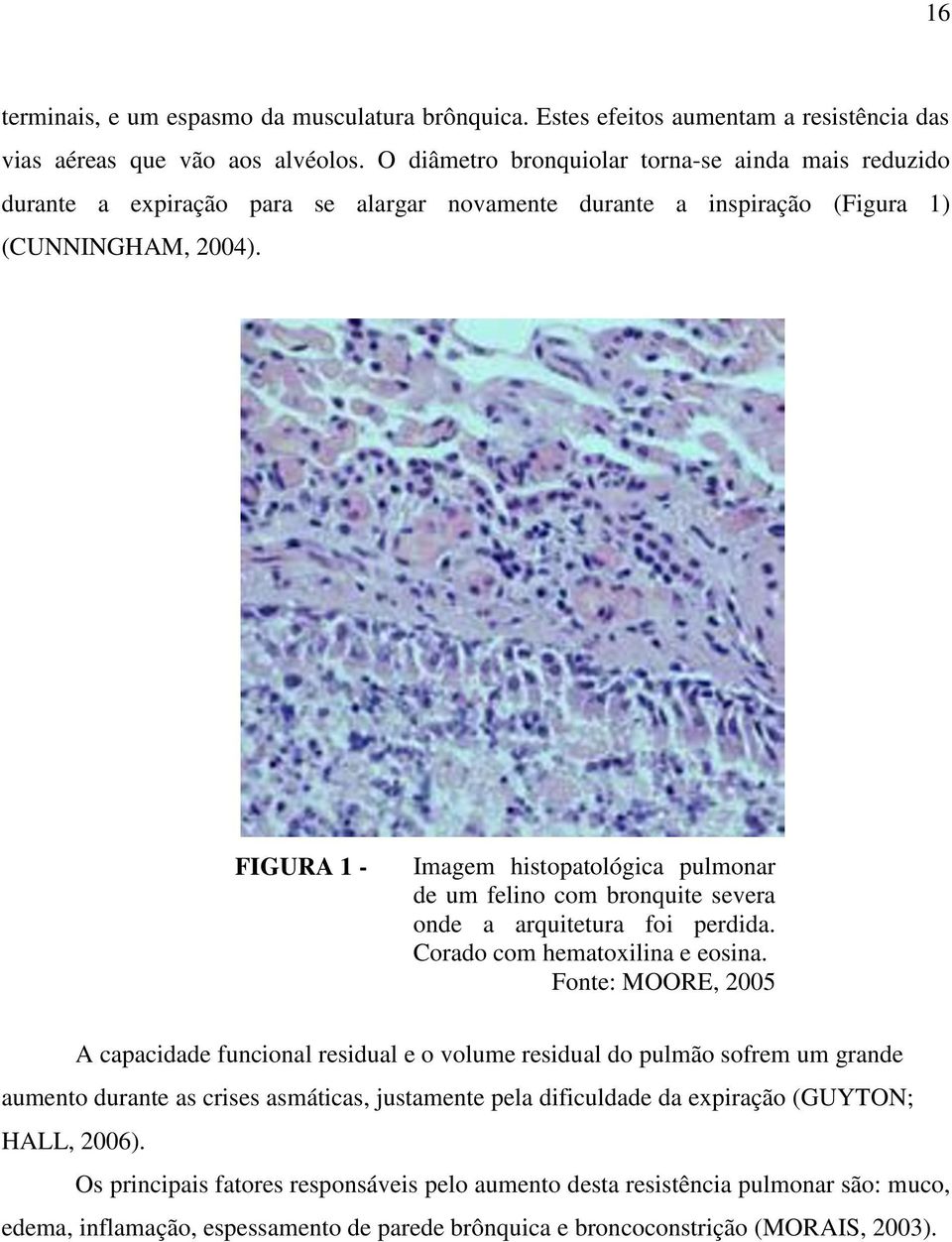 FIGURA 1 - Imagem histopatológica pulmonar de um felino com bronquite severa onde a arquitetura foi perdida. Corado com hematoxilina e eosina.