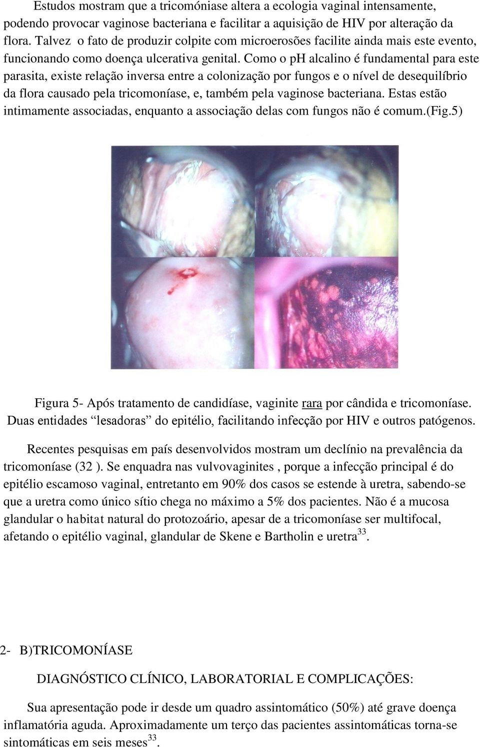 Como o ph alcalino é fundamental para este parasita, existe relação inversa entre a colonização por fungos e o nível de desequilíbrio da flora causado pela tricomoníase, e, também pela vaginose