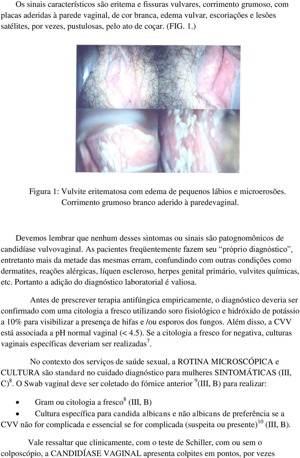 Devemos lembrar que nenhum desses sintomas ou sinais são patognomônicos de candidíase vulvovaginal.