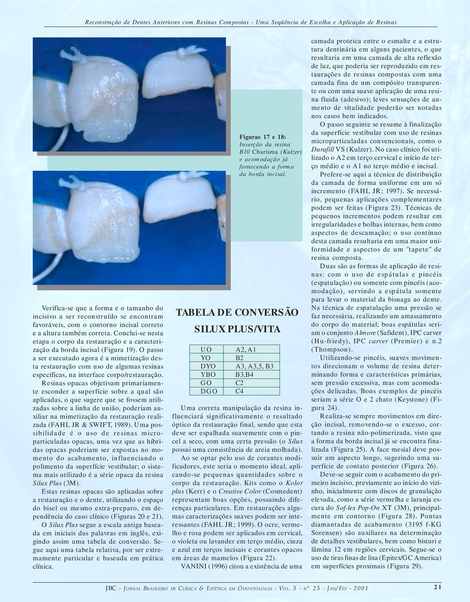 O passo a ser executado agora é a mimetização desta restauração com uso de algumas resinas específicas, na interface corpo/restauração.