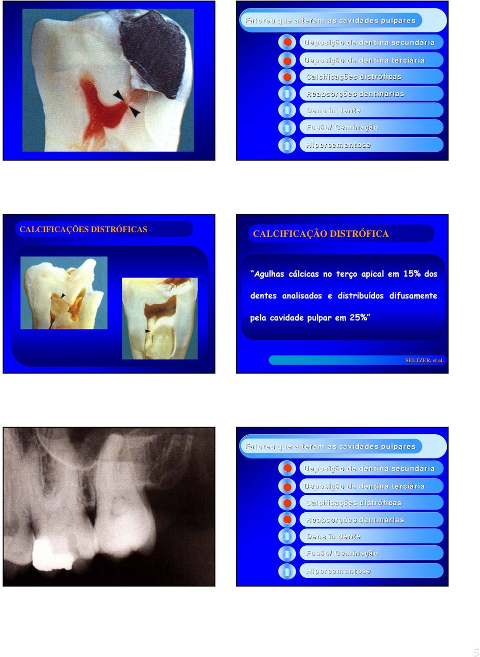 dos dentes analisados e distribuídos difusamente pela cavidade pulpar em 25% SELTZER, et al.