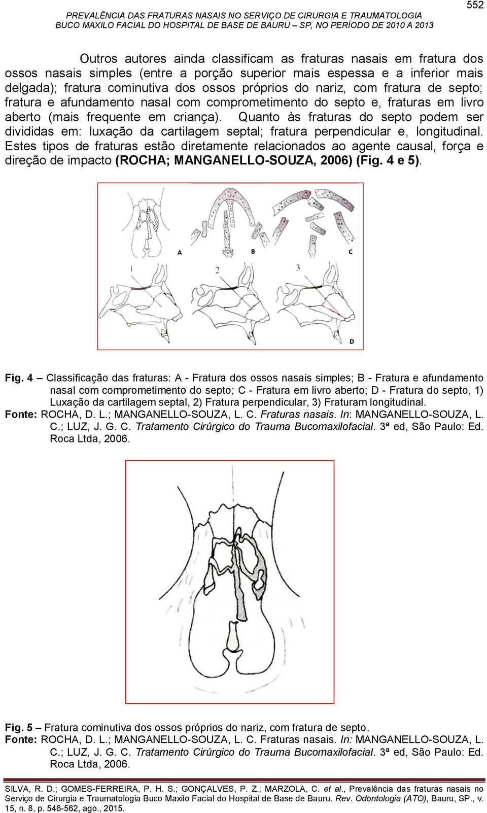 Quanto às fraturas do septo podem ser divididas em: luxação da cartilagem septal; fratura perpendicular e, longitudinal.