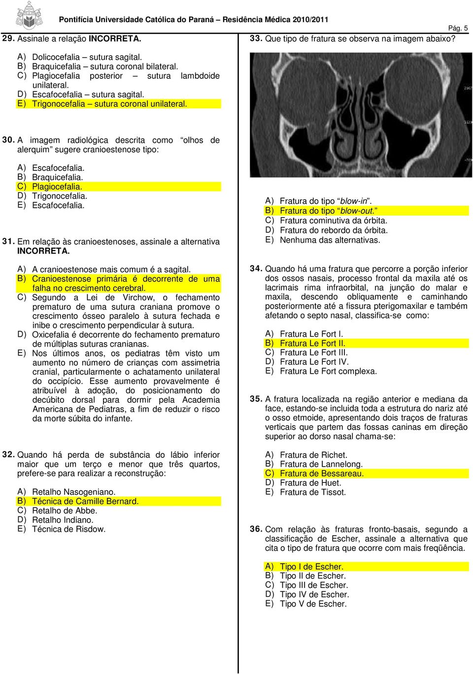 A imagem radiológica descrita como olhos de alerquim sugere cranioestenose tipo: A) Escafocefalia. B) Braquicefalia. C) Plagiocefalia. D) Trigonocefalia. E) Escafocefalia. 31.