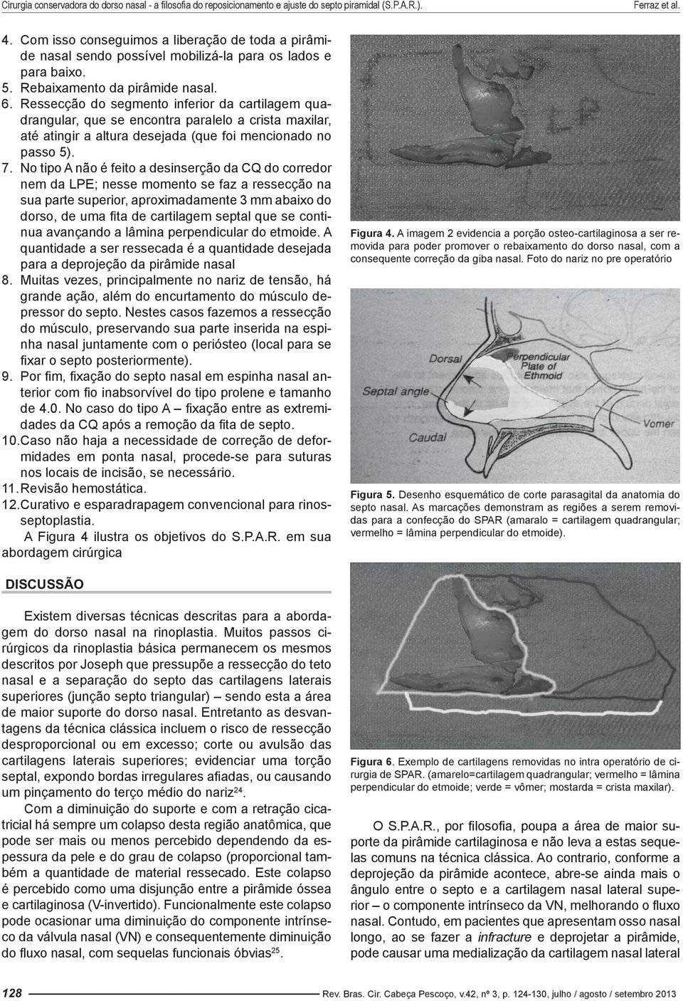 No tipo A não é feito a desinserção da CQ do corredor nem da LPE; nesse momento se faz a ressecção na sua parte superior, aproximadamente 3 mm abaixo do dorso, de uma fita de cartilagem septal que se