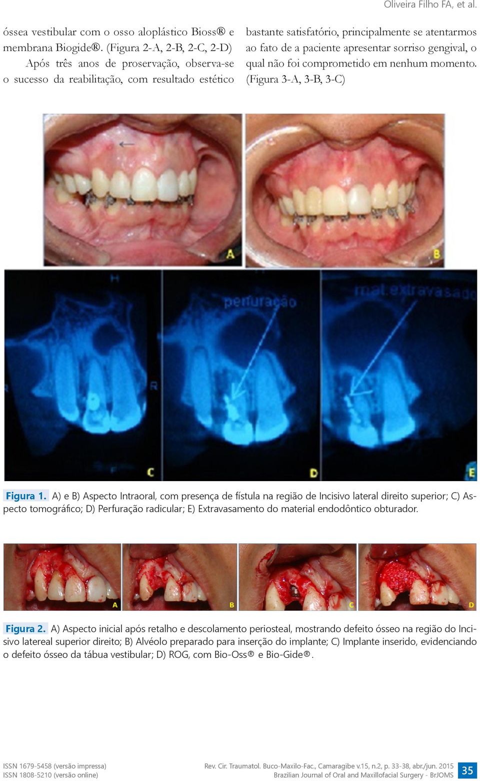 apresentar sorriso gengival, o qual não foi comprometido em nenhum momento. (Figura 3-A, 3-B, 3-C) Figura 1.