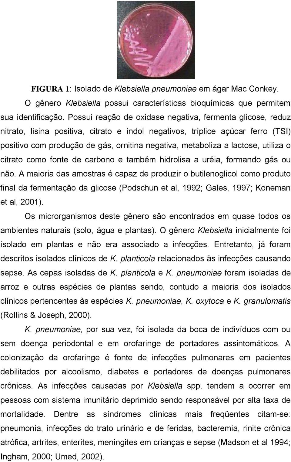 a lactose, utiliza o citrato como fonte de carbono e também hidrolisa a uréia, formando gás ou não.