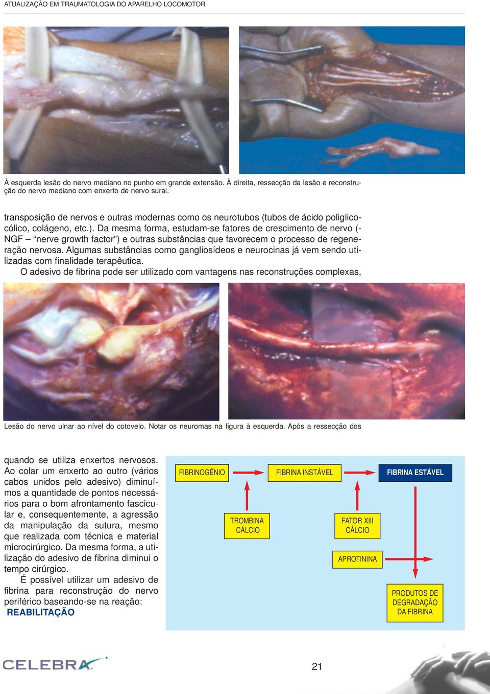 Da mesma forma, estudam-se fatores de crescimento de nervo (- NGF nerve growth factor ) e outras substâncias que favorecem o processo de regeneração nervosa.