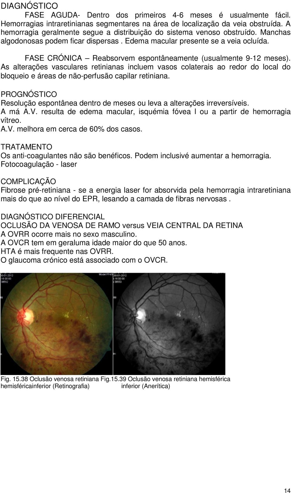 FASE CRÓNICA Reabsorvem espontâneamente (usualmente 9-12 meses). As alterações vasculares retinianas incluem vasos colaterais ao redor do local do bloqueio e áreas de não-perfusão capilar retiniana.