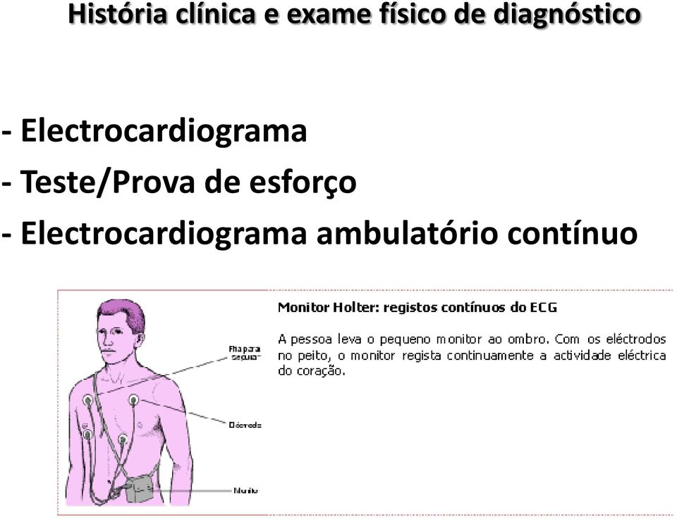 Electrocardiograma - Teste/Prova