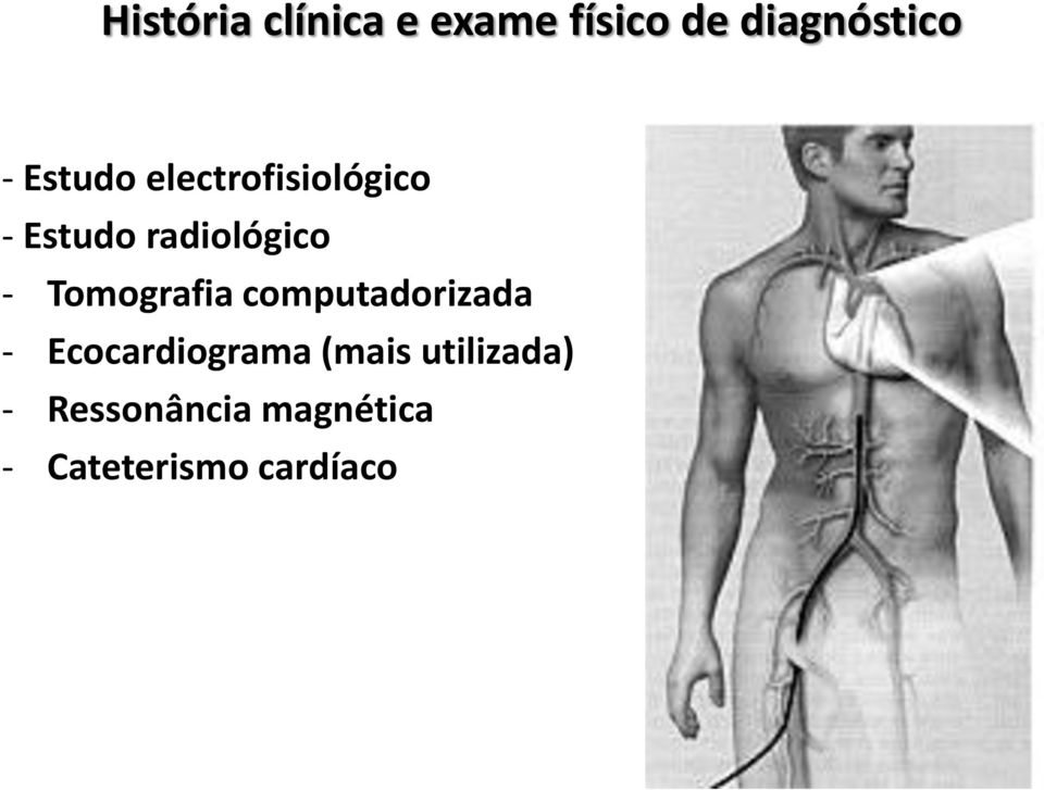 Tomografia computadorizada - Ecocardiograma (mais