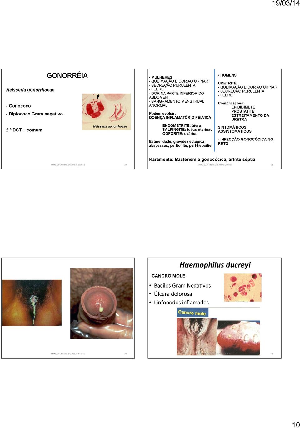 peritonite, peri-hepatite HOMENS URETRITE - QUEIMAÇÃO E DOR AO URINAR - SECREÇÃO PURULENTA - FEBRE Complicações: EPIDIDIMETE PROSTATITE ESTREITAMENTO DA URÉTRA SINTOMÁTICOS