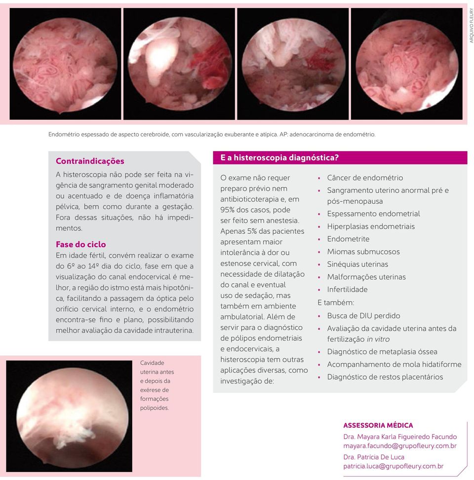 Fase do ciclo Em idade fértil, convém realizar o exame do 6º ao 14º dia do ciclo, fase em que a visualização do canal endocervical é melhor, a região do istmo está mais hipotônica, facilitando a