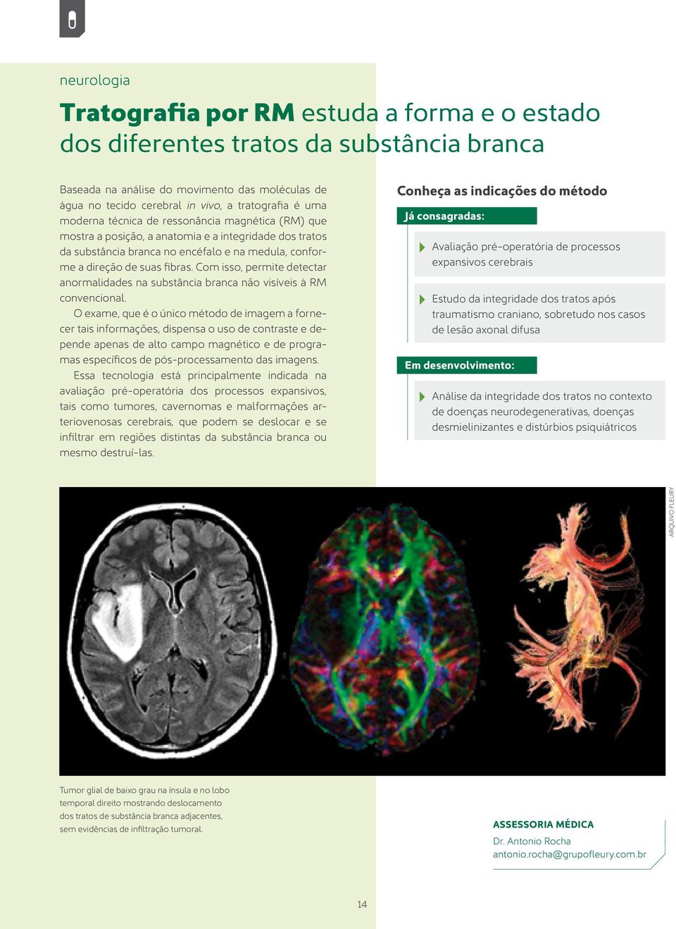 Com isso, permite detectar anormalidades na substância branca não visíveis à RM convencional.