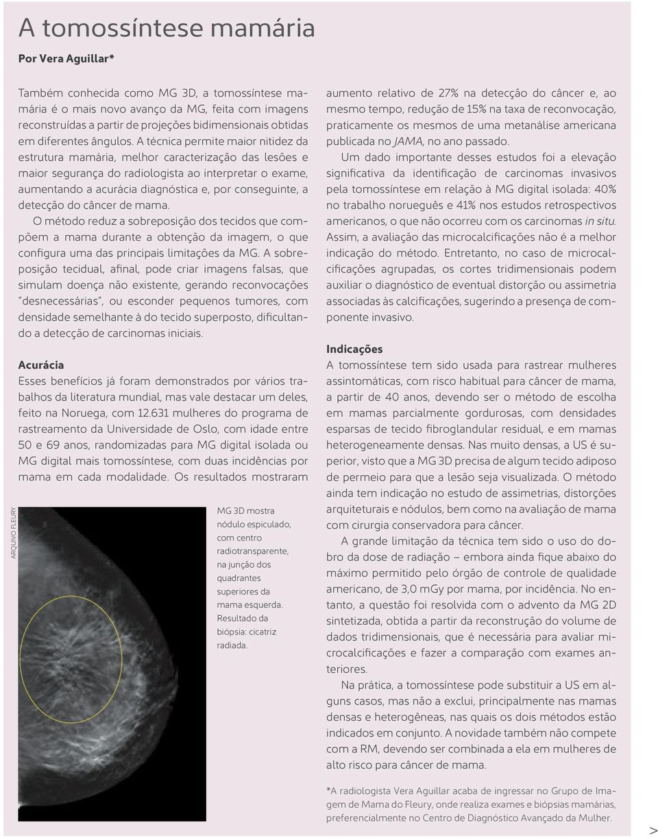 A técnica permite maior nitidez da estrutura mamária, melhor caracterização das lesões e maior segurança do radiologista ao interpretar o exame, aumentando a acurácia diagnóstica e, por conseguinte,