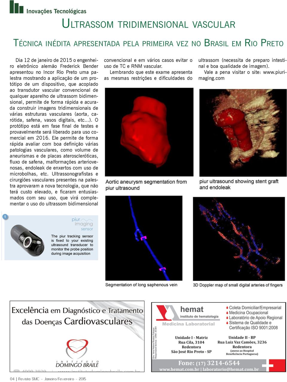 bidimensional, permite de forma rápida e acurada construir imagens tridimensionais de várias estruturas vasculares (aorta, carótida, safena, vasos digitais, etc...).