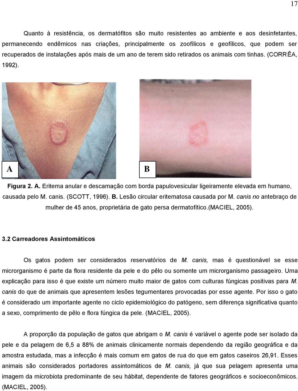 a B b Figura 2. A. Eritema anular e descamação com borda papulovesicular ligeiramente elevada em humano, causada pelo M. canis. (SCOTT, 1996). B. Lesão circular eritematosa causada por M.