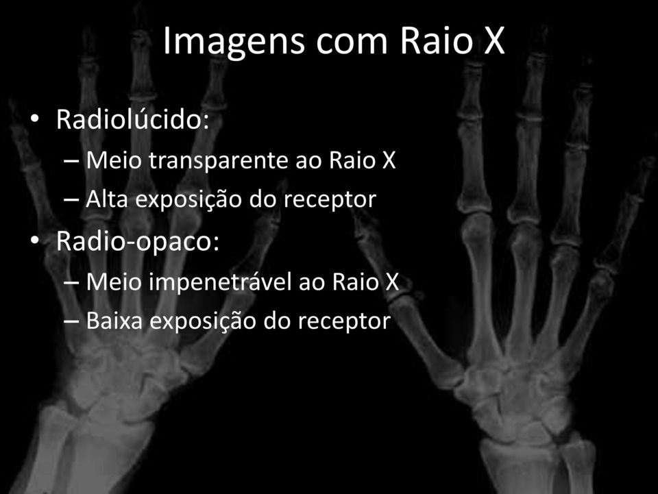 do receptor Radio-opaco: Meio