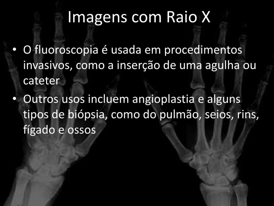 agulha ou cateter Outros usos incluem angioplastia e