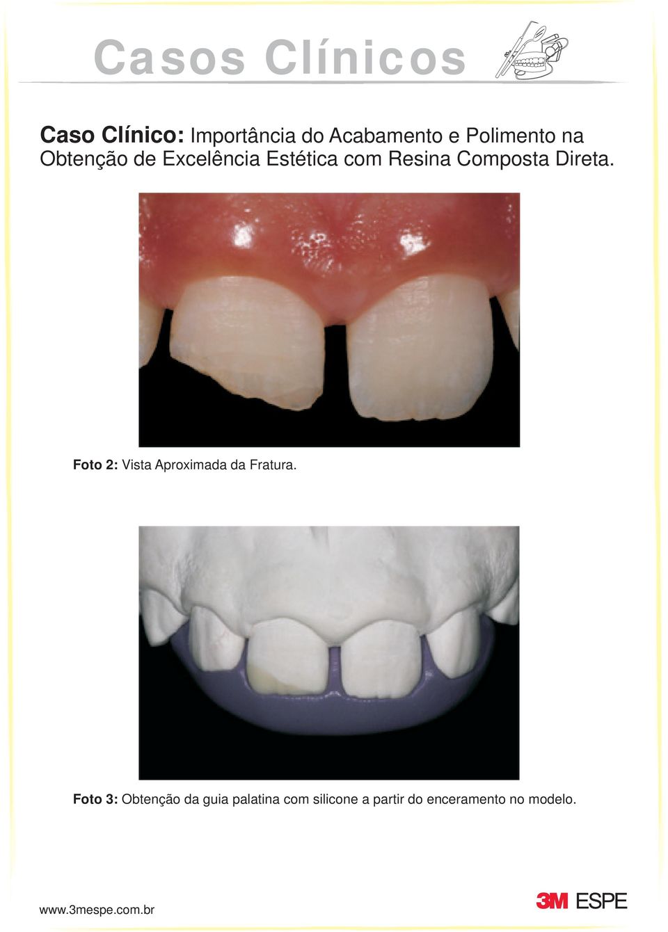 Foto 3: Obtenção da guia