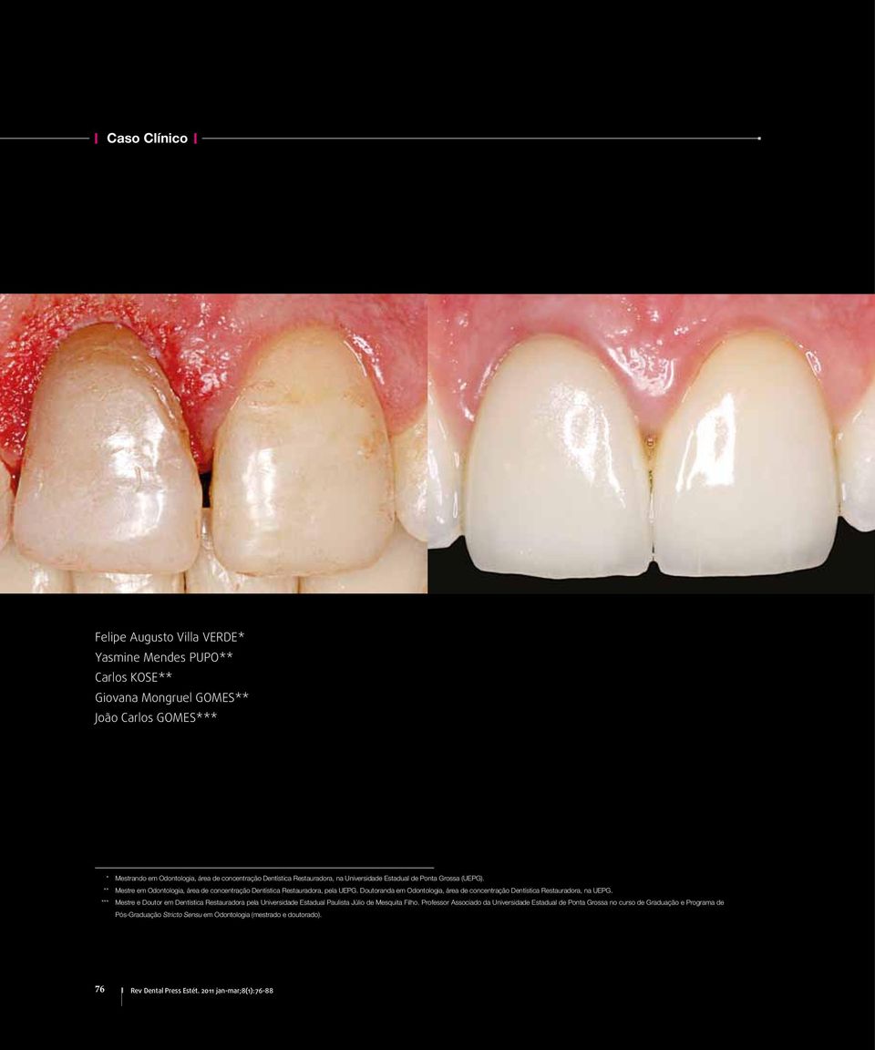 Doutoranda em Odontologia, área de concentração Dentística Restauradora, na UEPG.