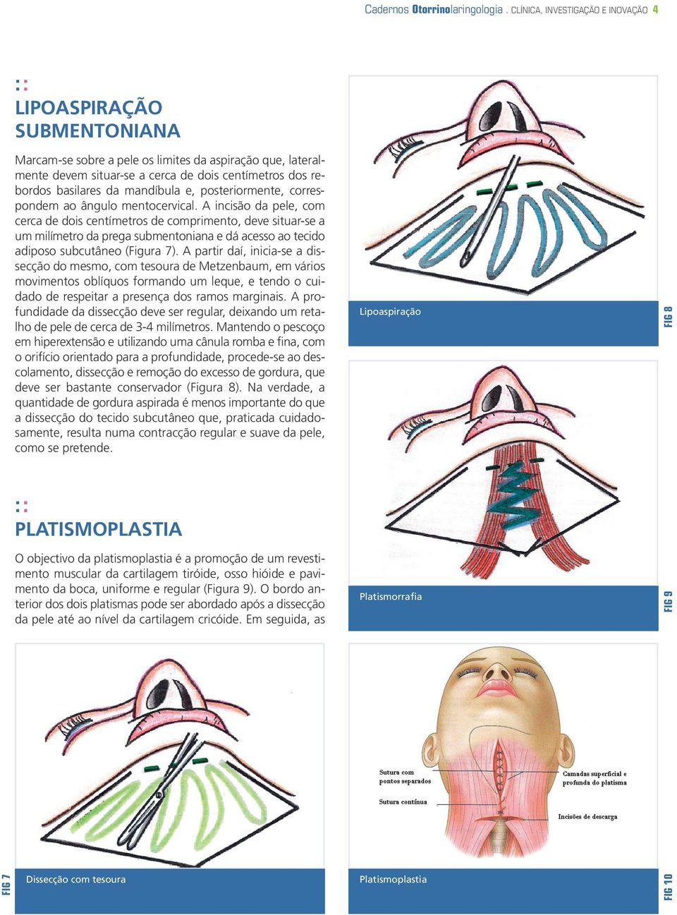 mandíbula e, posteriormente, correspondem ao ângulo mentocervical.