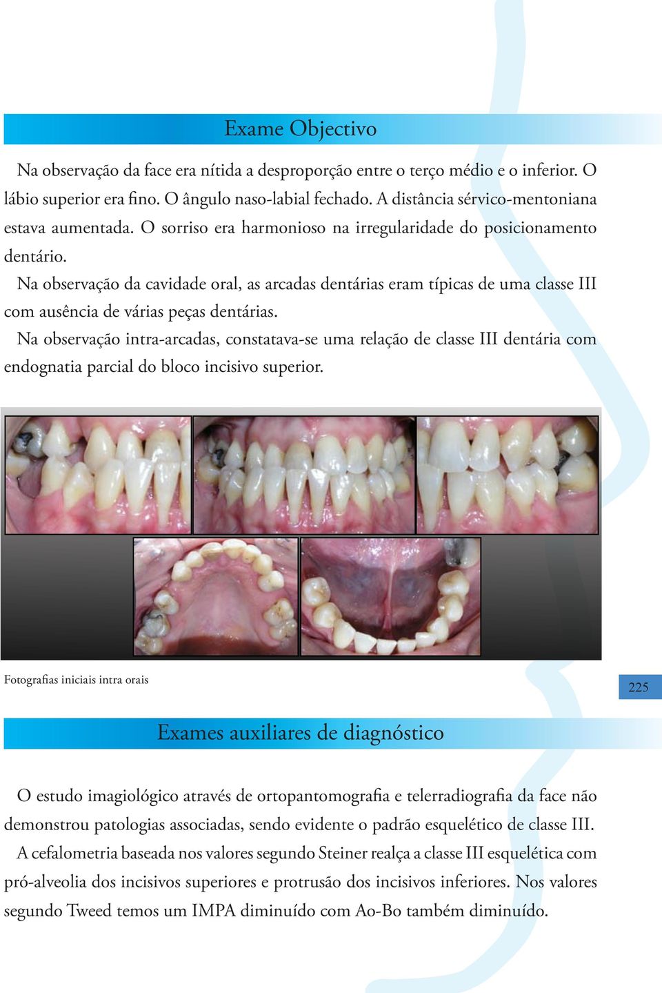 Na observação da cavidade oral, as arcadas dentárias eram típicas de uma classe III com ausência de várias peças dentárias.