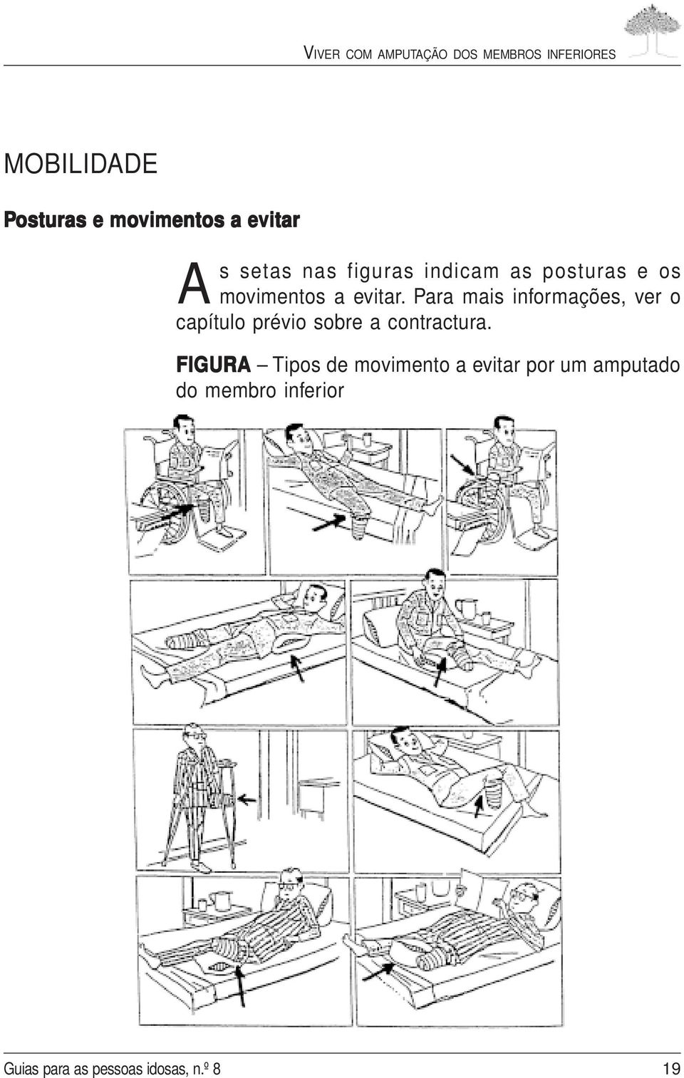 Para mais informações, ver o capítulo prévio sobre a contractura.