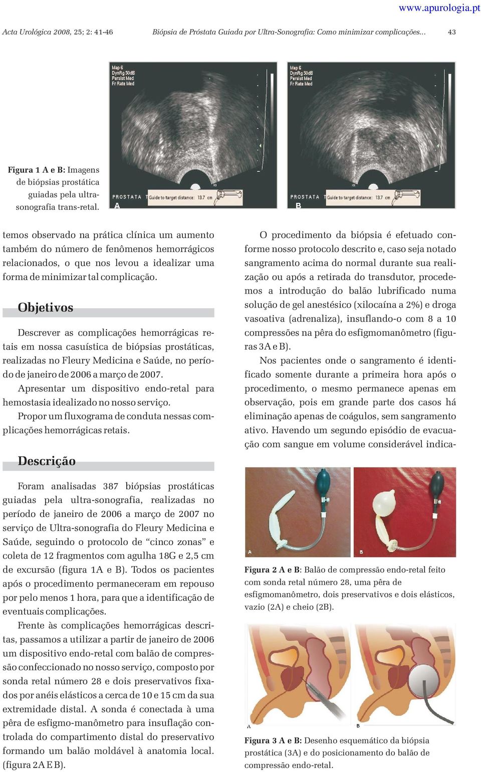 Objetivos Descrever as complicações hemorrágicas retais em nossa casuística de biópsias prostáticas, realizadas no Fleury Medicina e Saúde, no período de janeiro de 2006 a março de 2007.