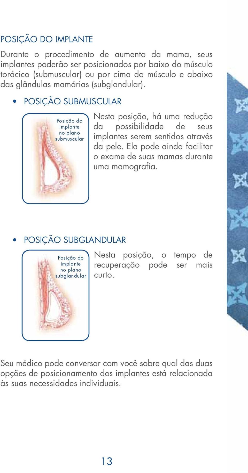 Posição submuscular Posição do implante no plano submuscular Nesta posição, há uma redução da possibilidade de seus implantes serem sentidos através da pele.