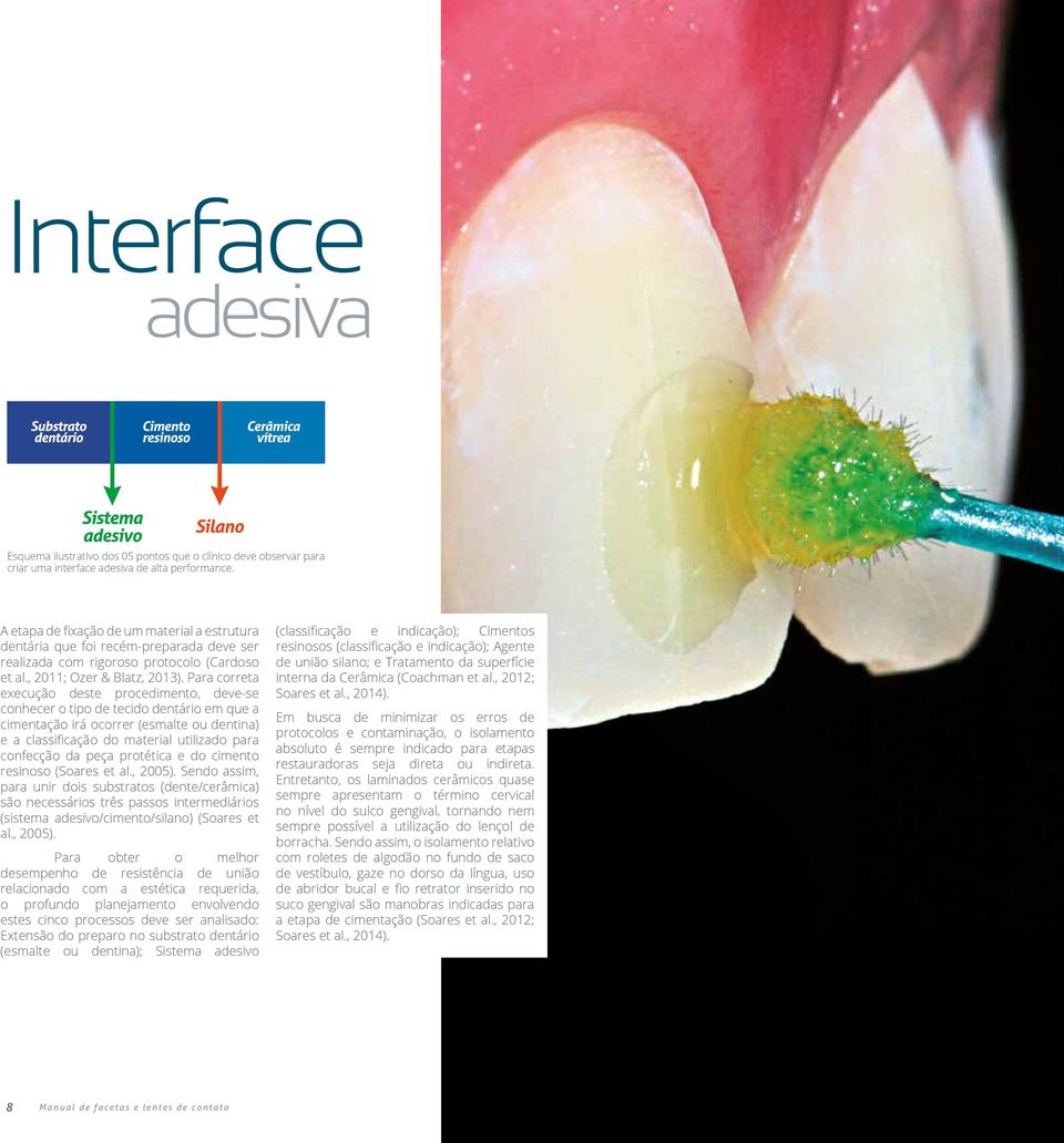 Para correta execução deste procedimento, deve-se conhecer o tipo de tecido dentário em que a cimentação irá ocorrer (esmalte ou dentina) e a classificação do material utilizado para confecção da