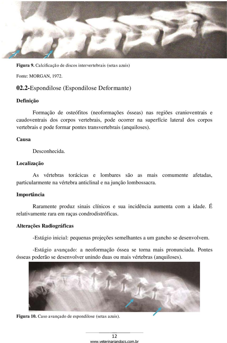 corpos vertebrais e pode formar pontes transvertebrais (anquiloses). Causa Localização Desconhecida.