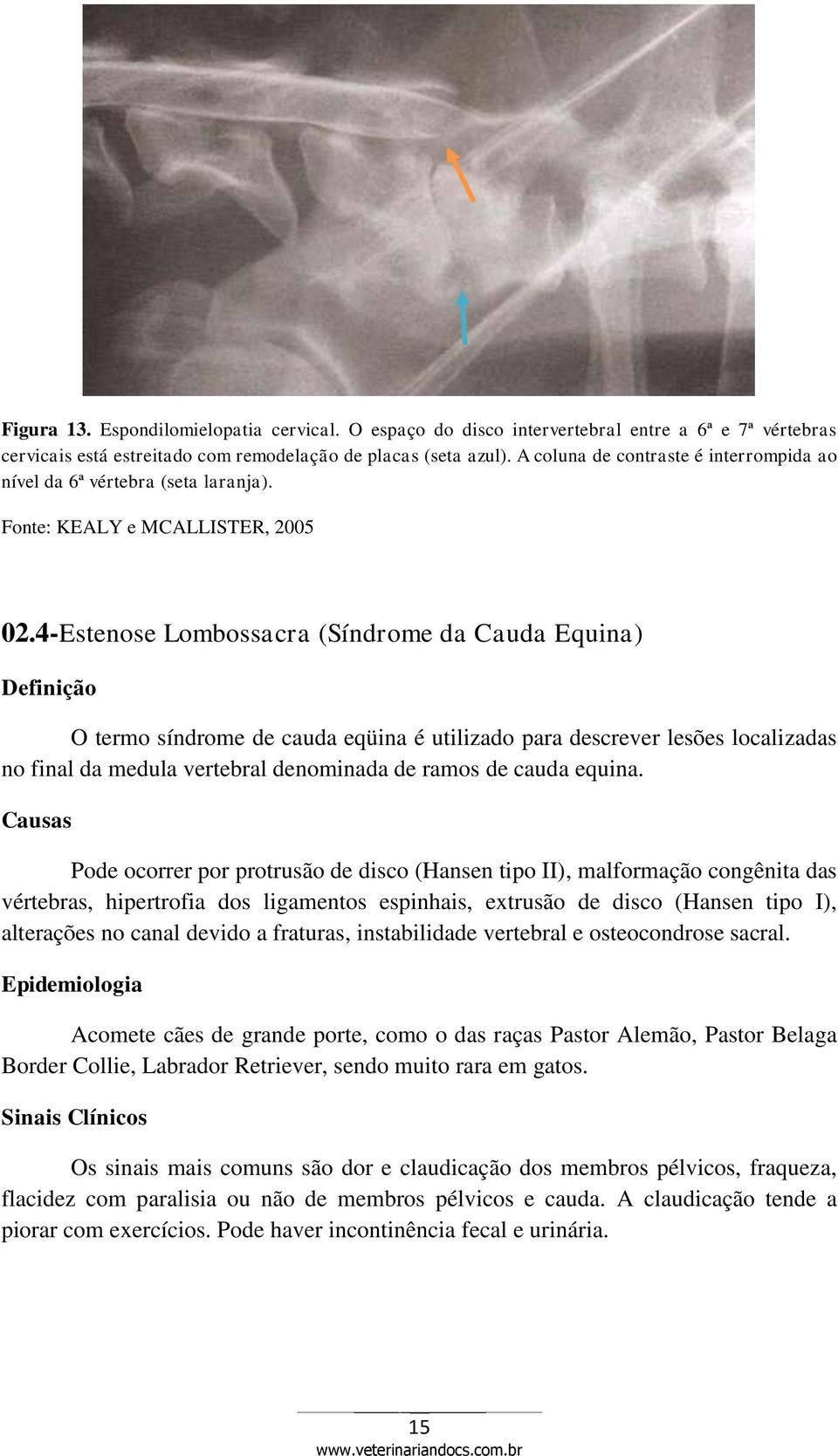 4-Estenose Lombossacra (Síndrome da Cauda Equina) Definição O termo síndrome de cauda eqüina é utilizado para descrever lesões localizadas no final da medula vertebral denominada de ramos de cauda