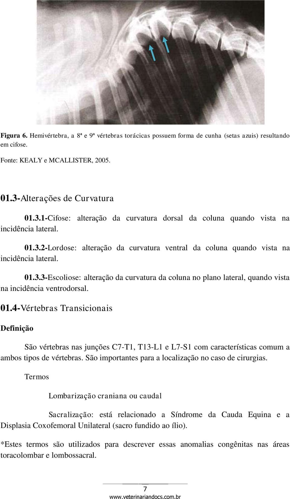 01.3.3-Escoliose: alteração da curvatura da coluna no plano lateral, quando vista na incidência ventrodorsal. 01.