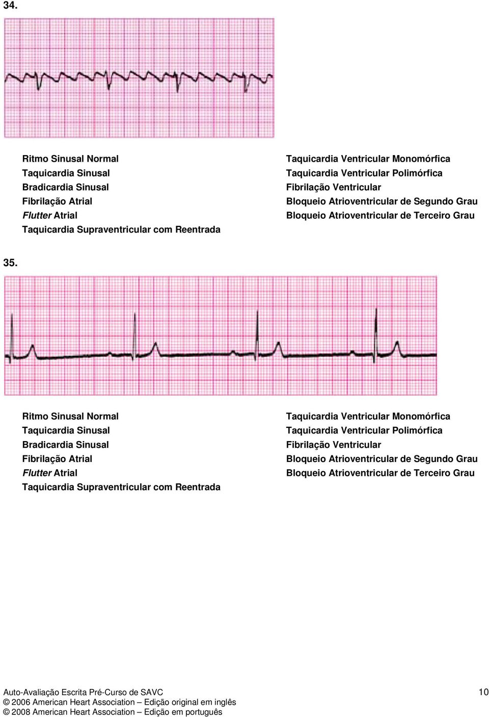 Ritmo Sinusal Normal Taquicardia Sinusal Bradicardia Sinusal Fibrilação Atrial Flutter Atrial Taquicardia Supraventricular com Reentrada Taquicardia Ventricular Monomórfica Taquicardia Ventricular