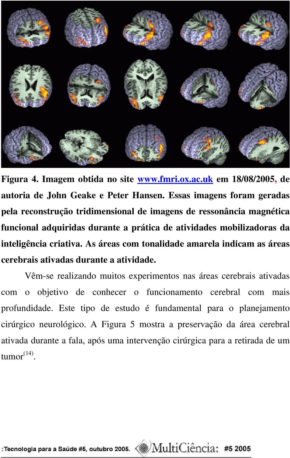 criativa. As áreas com tonalidade amarela indicam as áreas cerebrais ativadas durante a atividade.