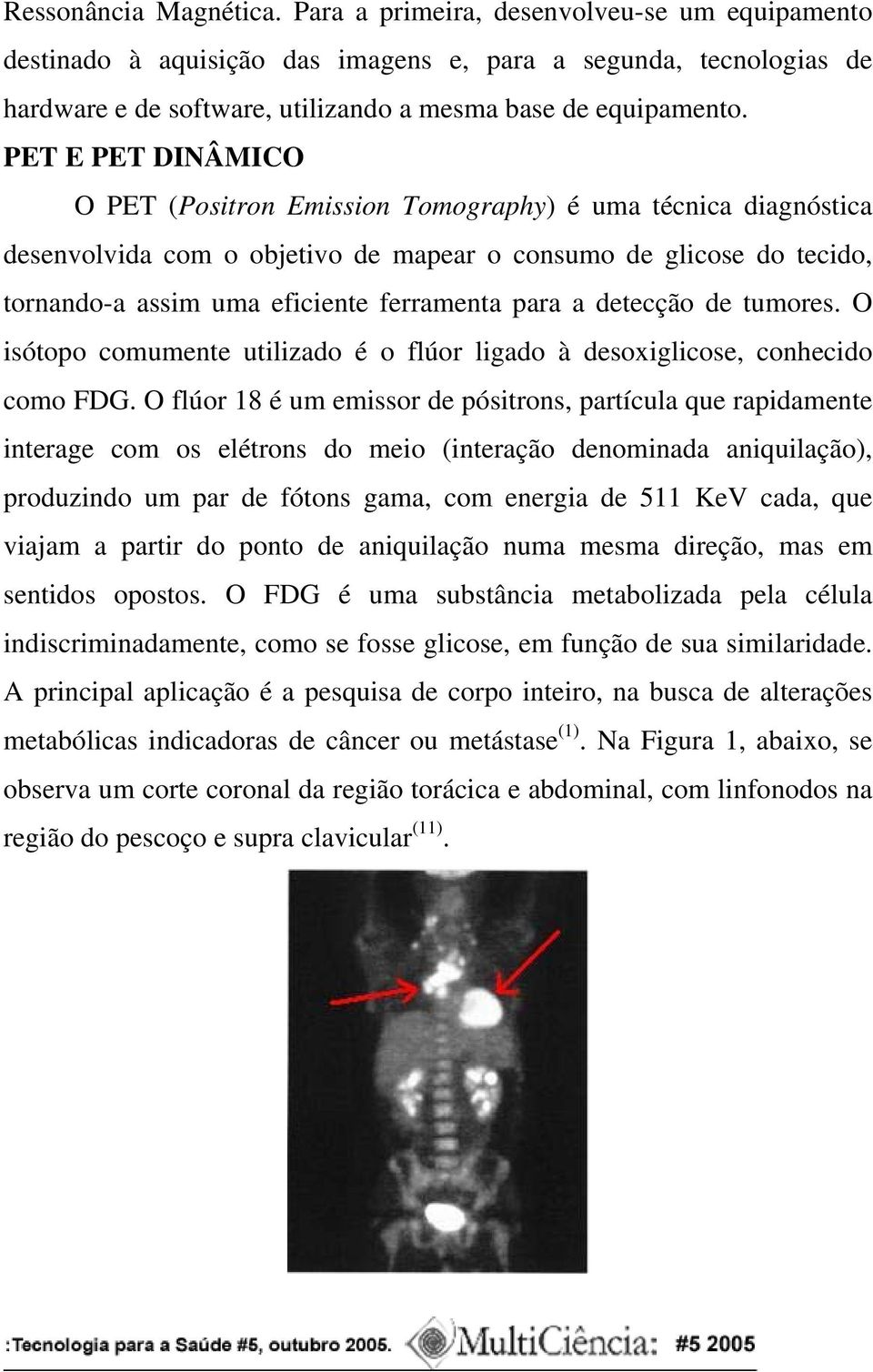 PET E PET DINÂMICO O PET (Positron Emission Tomography) é uma técnica diagnóstica desenvolvida com o objetivo de mapear o consumo de glicose do tecido, tornando-a assim uma eficiente ferramenta para