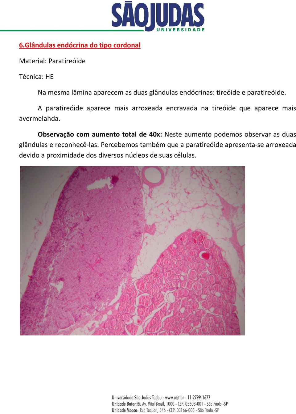 A paratireóide aparece mais arroxeada encravada na tireóide que aparece mais avermelahda.