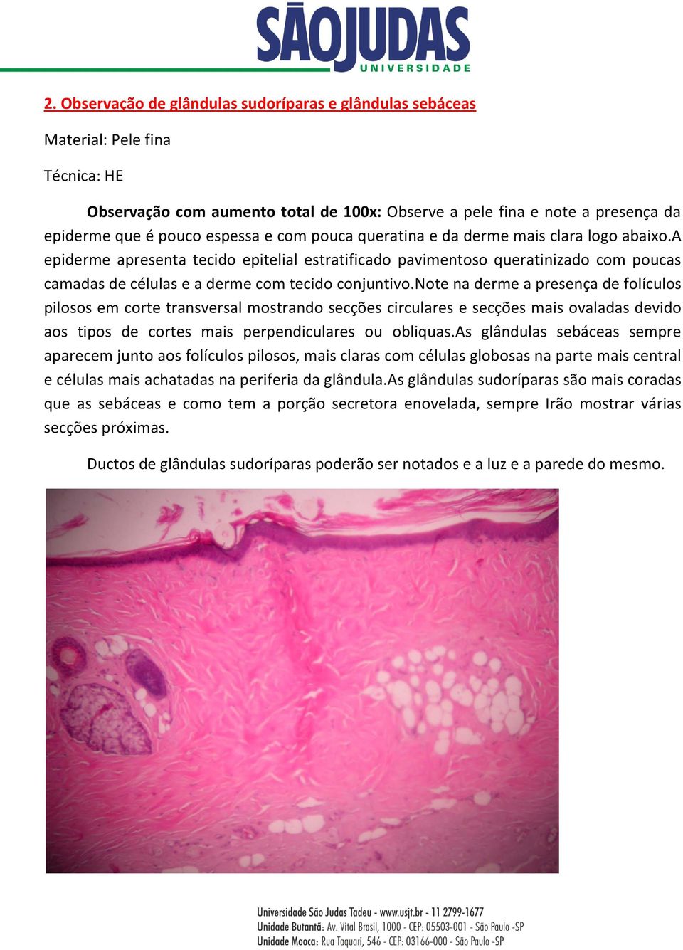 note na derme a presença de folículos pilosos em corte transversal mostrando secções circulares e secções mais ovaladas devido aos tipos de cortes mais perpendiculares ou obliquas.