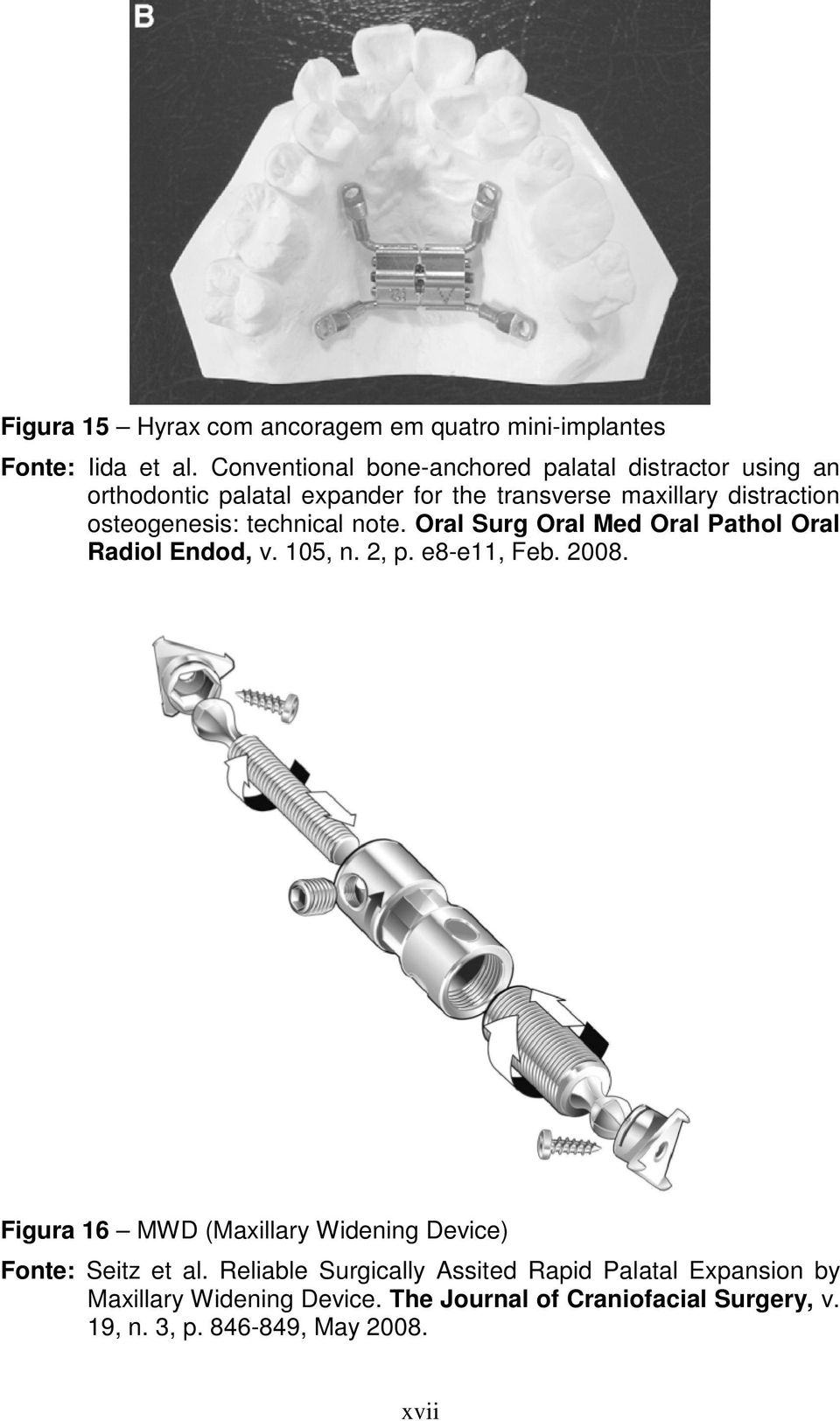 osteogenesis: technical note. Oral Surg Oral Med Oral Pathol Oral Radiol Endod, v. 105, n. 2, p. e8-e11, Feb. 2008.