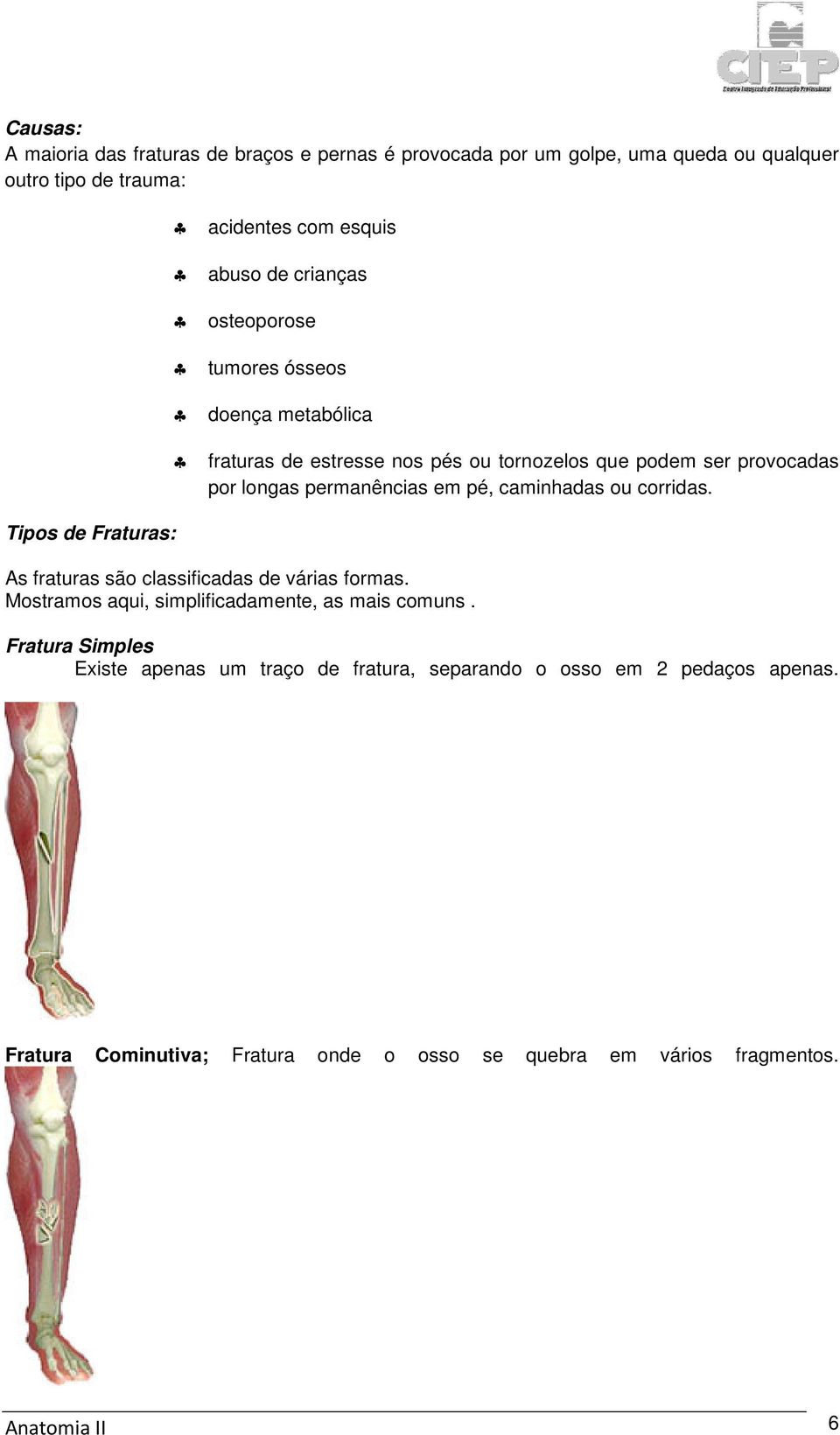 permanências em pé, caminhadas ou corridas. As fraturas são classificadas de várias formas. Mostramos aqui, simplificadamente, as mais comuns.