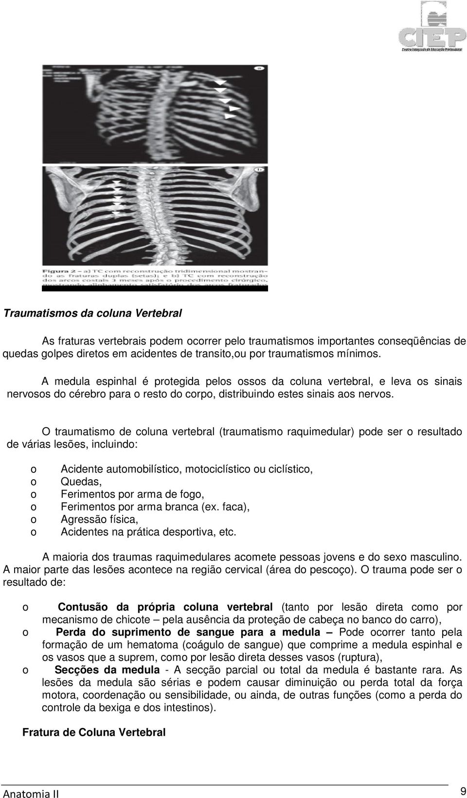 O traumatismo de coluna vertebral (traumatismo raquimedular) pode ser o resultado de várias lesões, incluindo: o o o o o o Acidente automobilístico, motociclístico ou ciclístico, Quedas, Ferimentos