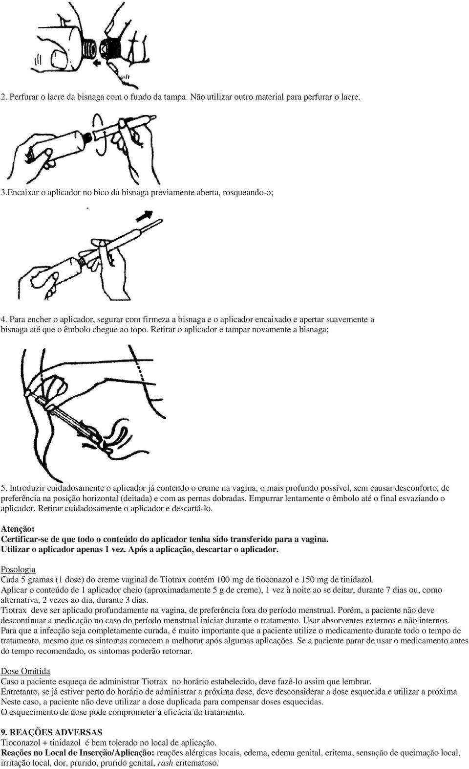 Introduzir cuidadosamente o aplicador já contendo o creme na vagina, o mais profundo possível, sem causar desconforto, de preferência na posição horizontal (deitada) e com as pernas dobradas.